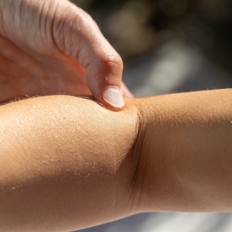 Triggerpunktbehandlung an Schulter, Ellenbogen, Hüfte und Knie
