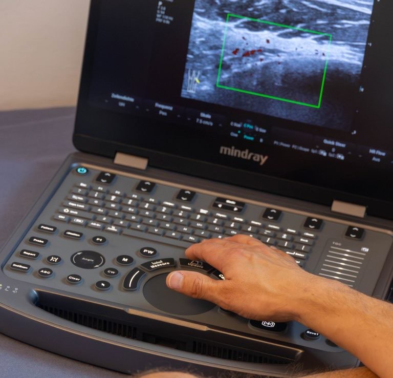 Ultraschalldiagnostik von Muskeln, Sehnen und Gelenken