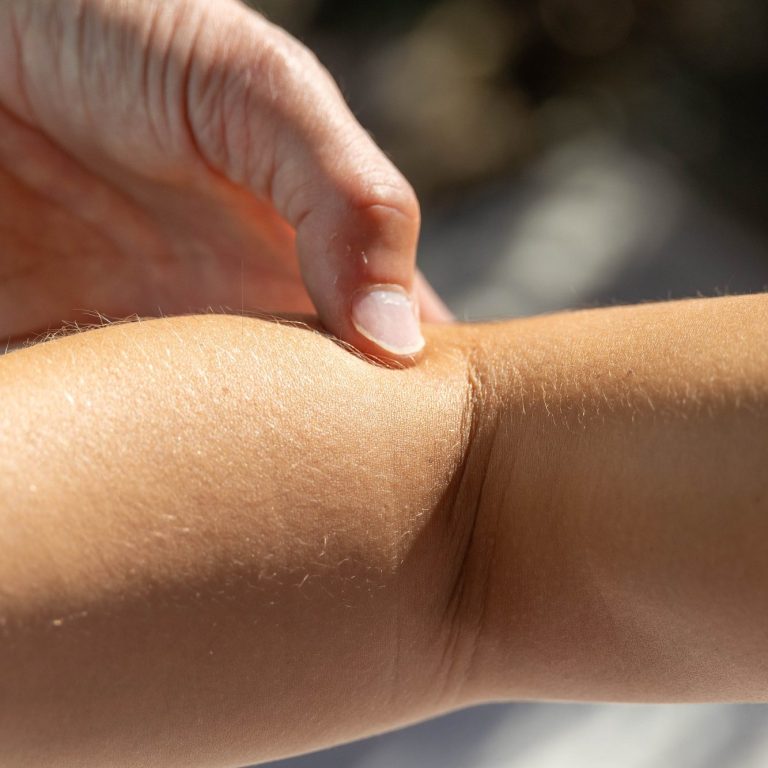 Dr. Güth behandelt einen Triggerpunkt am Unterarm einer Patientin.