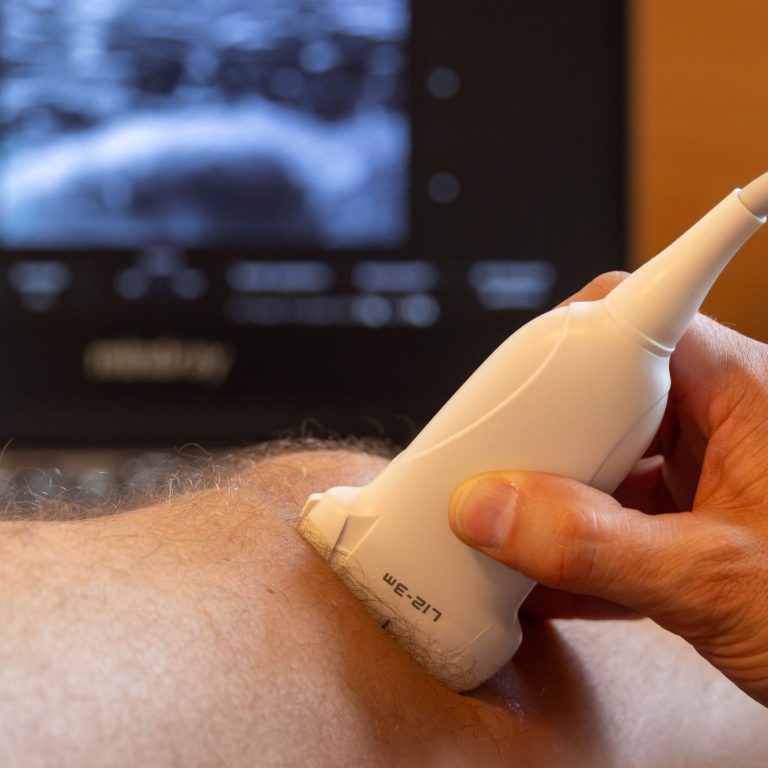 ESWT in Anwendung an einem Knie, im Hintergrund ist ein Bildschirm sichtbar.